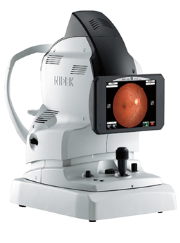 ニデック社オート無散瞳眼底カメラ