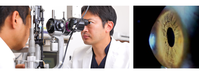 軽度 中等度 重度