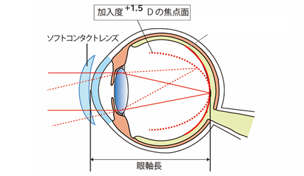 近視抑制のしくみ